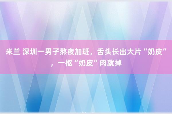米兰 深圳一男子熬夜加班，舌头长出大片“奶皮”，一抠“奶皮”肉就掉